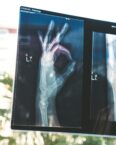 Image of an x-ray of a hand making an okay sign | SAP HCM CNT